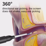 Ear Wax Cleaner with Camera (1080p) – For Entire Family - Image 7